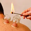 Cupping therapy
