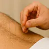 Acupuncture for back pain