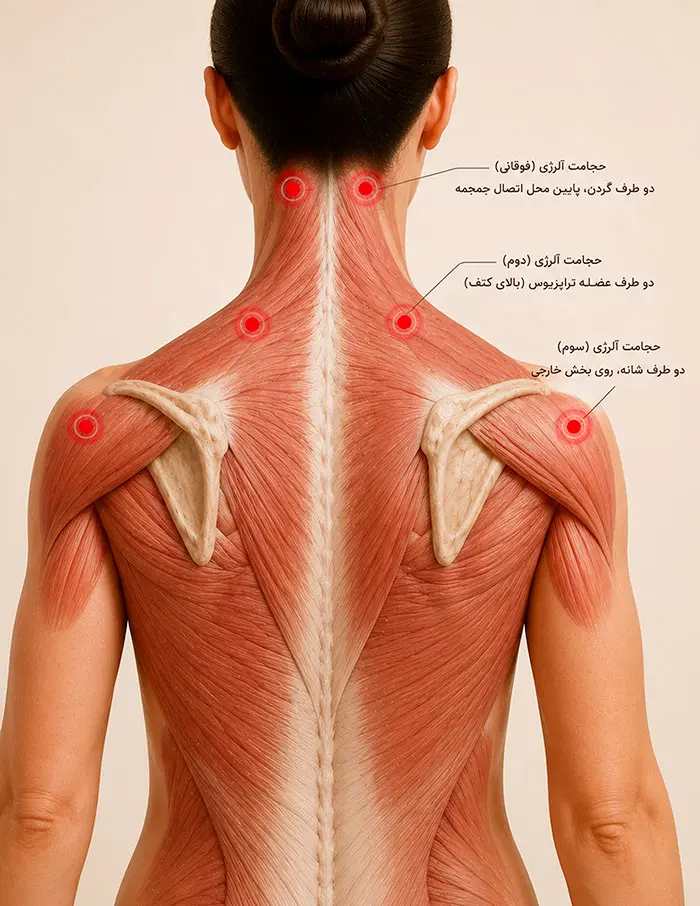 حجامت آلرژی