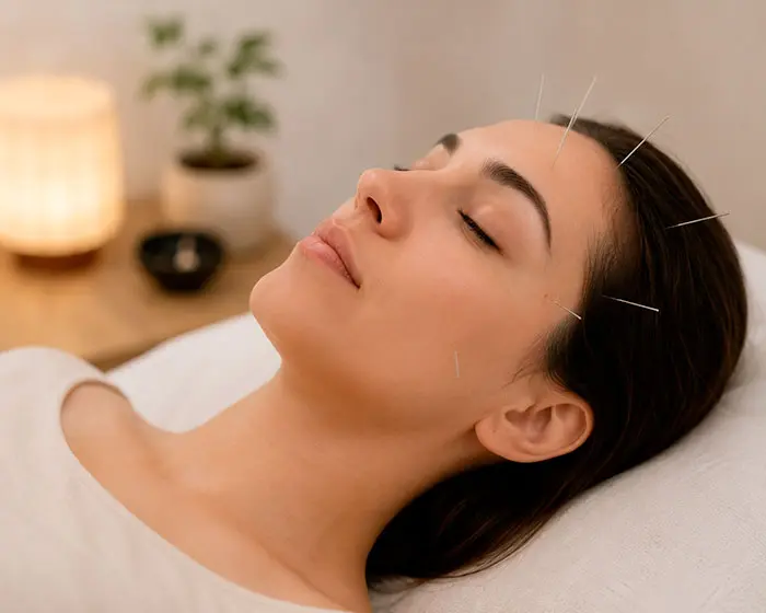 طب سوزنی برای اختلالات خواب