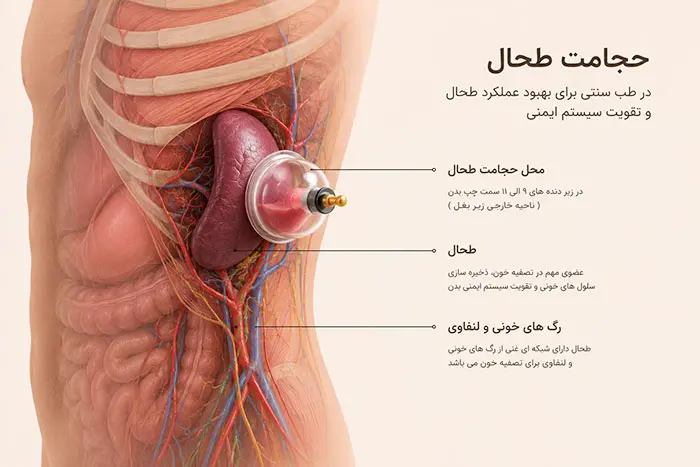 حجامت طحال